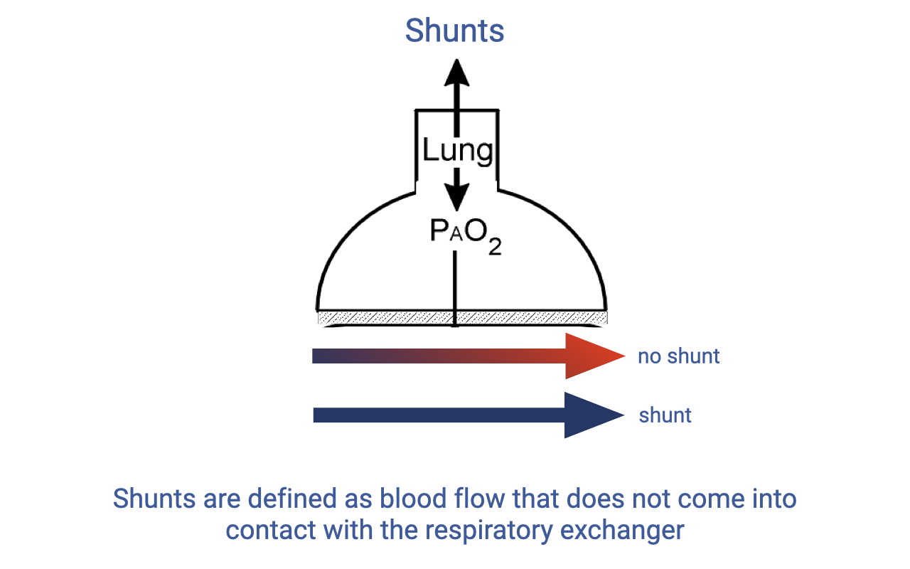 Diagram titled "Shunts." A schematic shows a lung connected to a capillary bed. Normally, blood flows through the capillary in contact with the alveolus (labeled P_AO2), becomes oxygenated, and exits as a red arrow ("no shunt"). In a shunt, blood bypasses the respiratory exchanger entirely and exits still deoxygenated (blue arrow, "shunt"). Text below: "Shunts are defined as blood flow that does not come into contact with the respiratory exchanger."