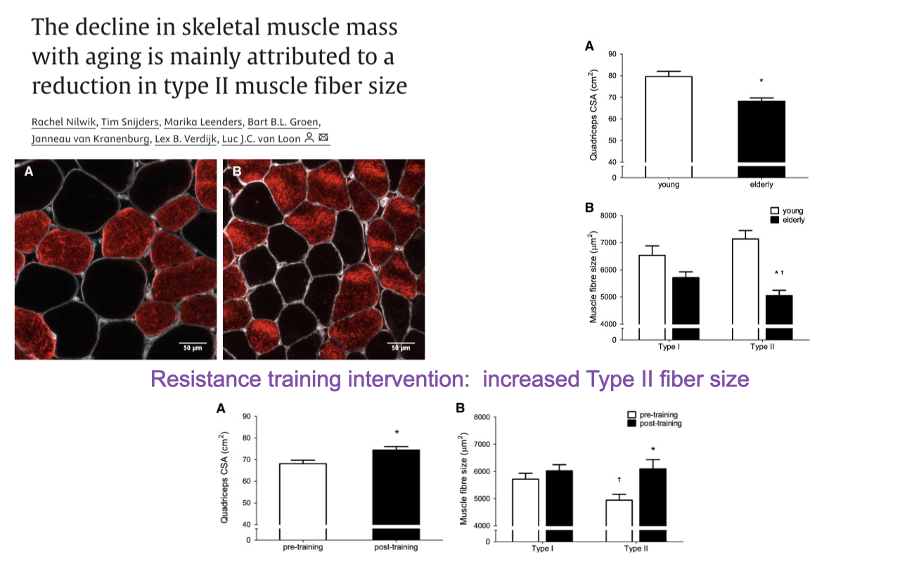Slide titled "The decline in skeletal muscle mass with aging is mainly attributed to a reduction in type II muscle fiber size" with a citation strip naming Rachel Nilwik, Tim Snijders, Marika Leenders, Bart B.L. Groen, Janneau van Kranenburg, Lex B. Verdijk, Luc J.C. van Loon. Top section: two muscle cross-section micrographs labeled (A) and (B) showing differently stained fibers, with one showing larger fibers and the other smaller. Two bar plots at the upper right plot quadricep CSA (cm², ~50–80) and Mean fiber area (μm², 0–8000) for type I (gray) and type II (black, with patterning) in young vs. elderly groups, showing a reduction in mean fiber area and quadricep CSA particularly for type II in the elderly. Bottom section header (red/pink): "Resistance training intervention: increased Type II fiber size." Two more bar plots in the lower right show similar metrics pre- and post-training in elderly, with type II fiber size increasing significantly post-training.