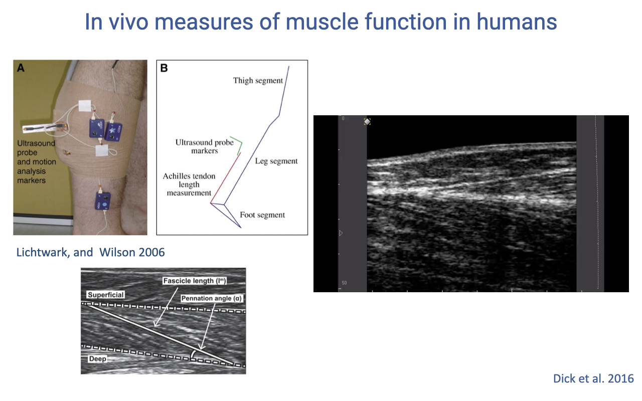 Slide titled "In vivo measures of muscle function in humans" — second iteration of the same title — with the Panel A photograph and Panel B segment-stick figure shown smaller in the upper-left, and a much larger B-mode ultrasound clip occupying the right half of the slide. The large ultrasound image shows the medial gastrocnemius mid-stride during walking, with the superficial and deep aponeuroses converging slightly and the diagonal fascicles visible at a pennation angle. Citation labels "Lichtwark, and Wilson 2006" at lower left and "Dick et al. 2016" at lower right.