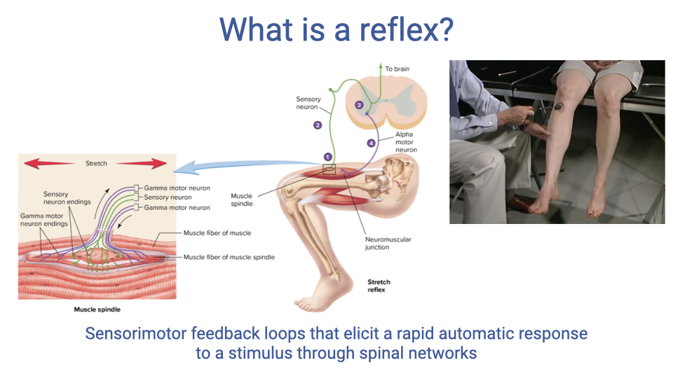 Slide titled "What is a reflex?" showing the same muscle spindle and stretch reflex diagrams from Slide 3, plus a photograph of a clinician performing a knee-jerk tendon tap test on a patient. Text below states: "Sensorimotor feedback loops that elicit a rapid automatic response to a stimulus through spinal networks."